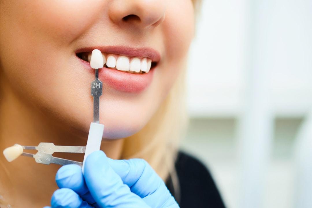 Professional Teeth Whitening Adelaide