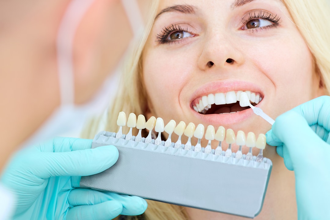 Dental Implants Adelaide